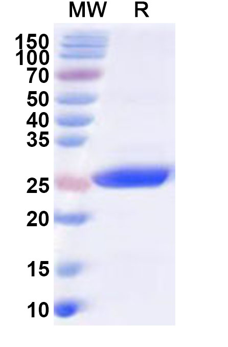 SDS-PAGE for Recombinant Human DSP Protein, N-His