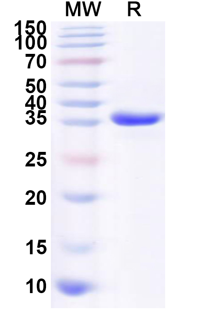 SDS-PAGE for Recombinant Human DTX2 Protein, N-His