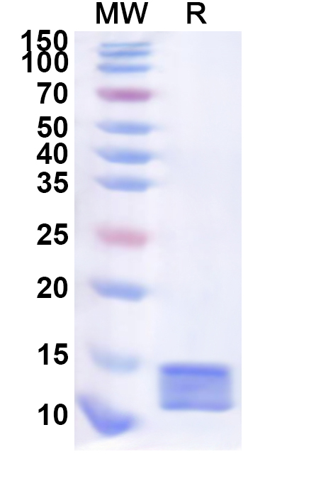 SDS-PAGE for Recombinant Human DUOXA2 Protein, N-His