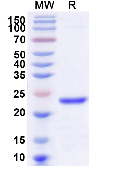 SDS-PAGE for Recombinant Human DUSP11, N-His