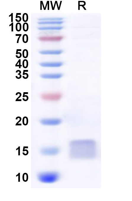 SDS-PAGE for Recombinant Human DYNLT3 Protein, N-His