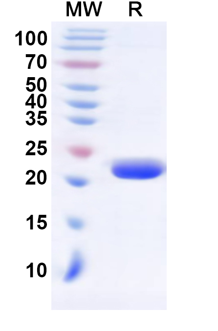 SDS-PAGE for Recombinant Human E2F5 Protein, N-His