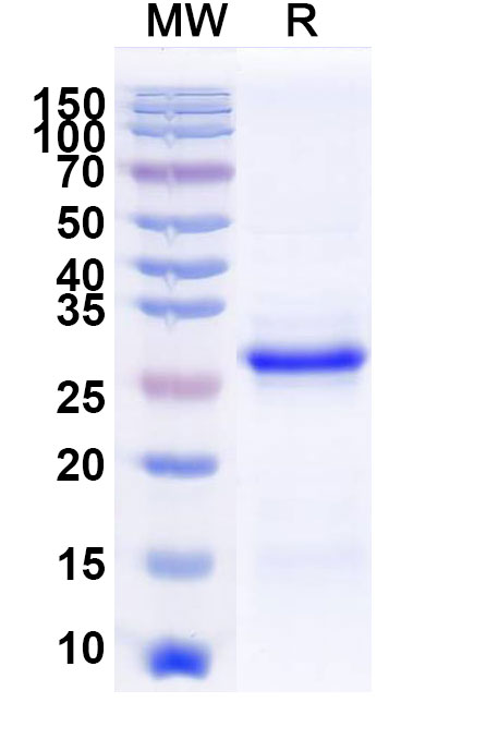 SDS-PAGE for Recombinant Human EEF1A1, N-His