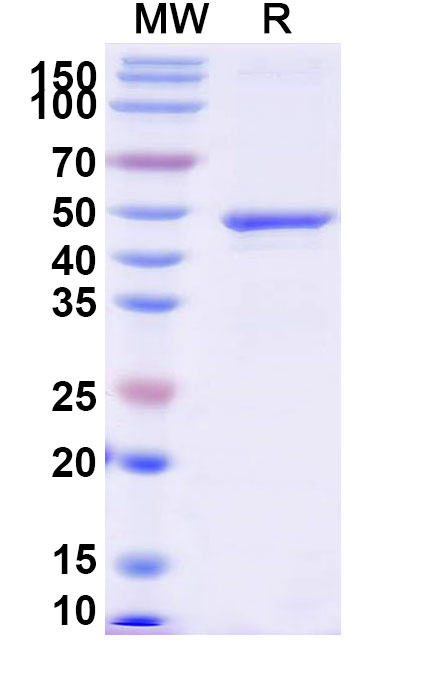 SDS-PAGE for Recombinant Human EGFR/ERBB1/HER1 Protein, N-His