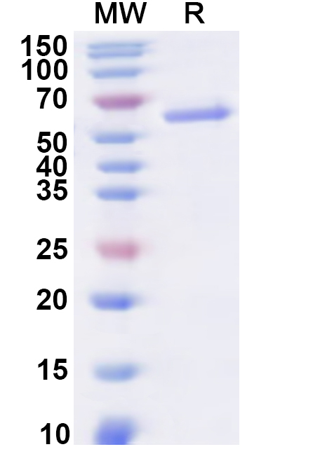 SDS-PAGE for Recombinant Human EIF2S3 Protein, N-His