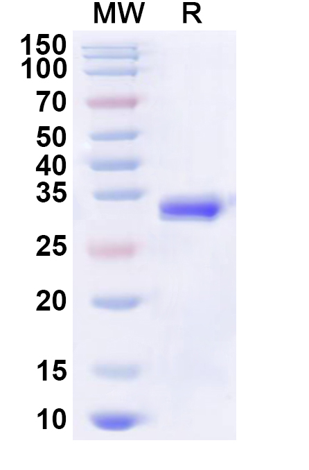 SDS-PAGE for Recombinant Human EIF4EBP2 Protein, N-His-KSI