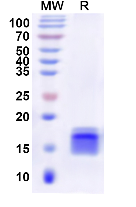 SDS-PAGE for Recombinant Human ELF3 Protein, N-His