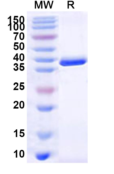 SDS-PAGE for Recombinant Human ELOVL4 Protein, N-GST & C-His