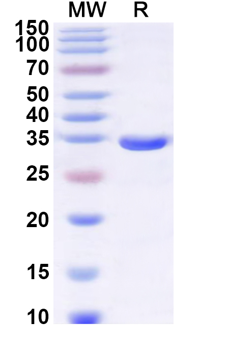 SDS-PAGE for Recombinant Human ELOVL6 Protein, N-GST & C-His