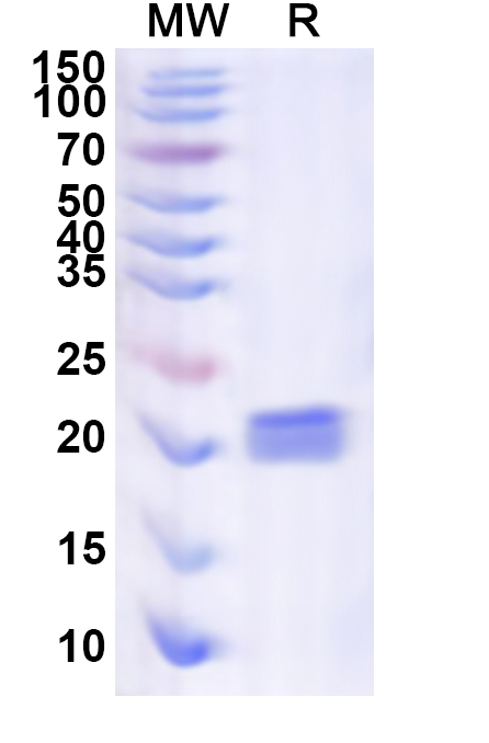 SDS-PAGE for Recombinant Human EMC10 Protein, N-His