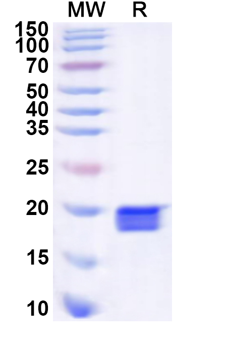 SDS-PAGE for Recombinant Human EMX2 Protein, N-His
