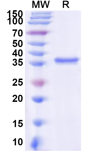 SDS-PAGE for Recombinant Human EPAS1 Protein, N-His