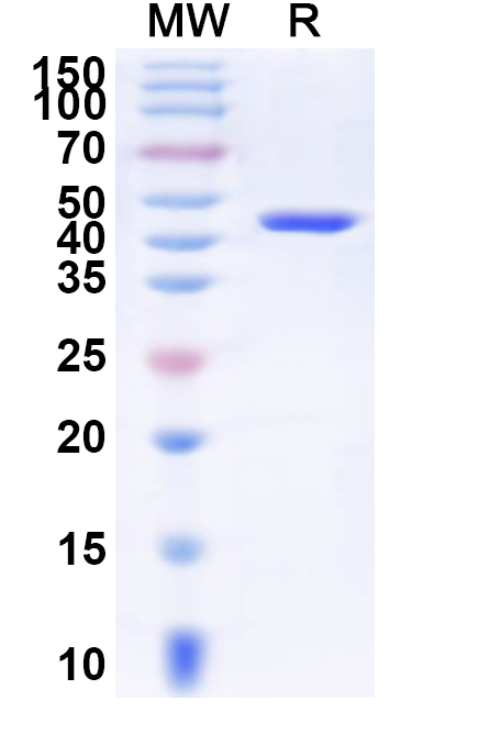 SDS-PAGE for Recombinant Human ERCC8 Protein, N-His