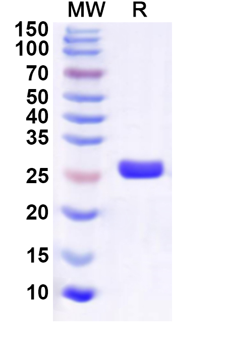 SDS-PAGE for Recombinant Human ESRRG Protein, N-His
