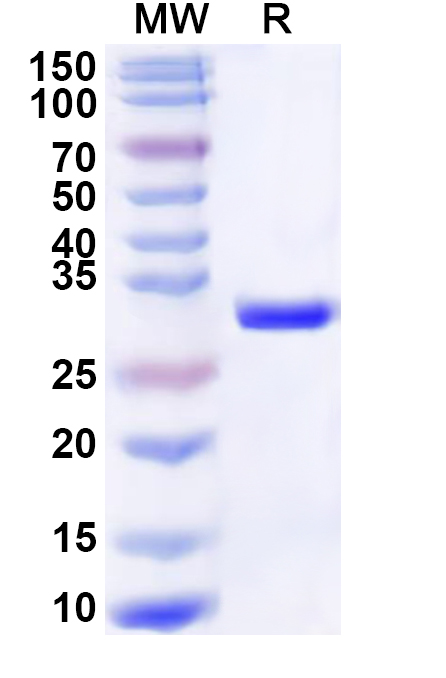 SDS-PAGE for Recombinant Human EVI2A Protein, N-His-KSI