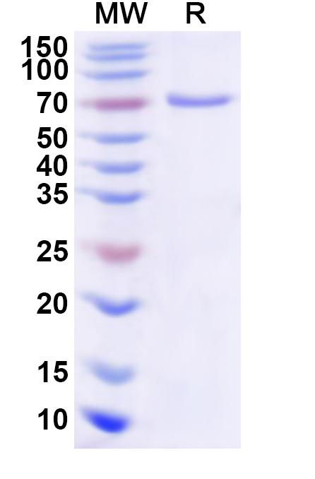SDS-PAGE for Recombinant Human EVX1 Protein, N-His-KSI