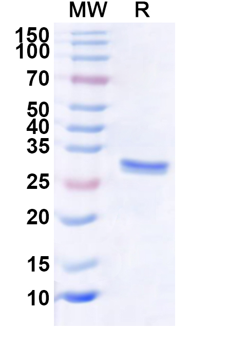 SDS-PAGE for Recombinant Human EXOSC6 Protein, N-His