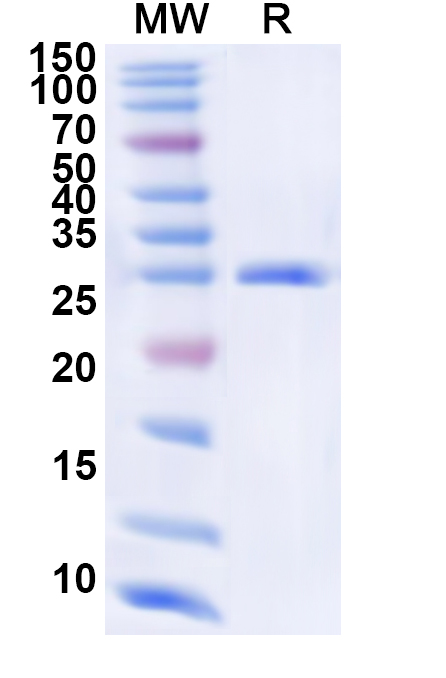 SDS-PAGE for Recombinant Human EXOSC7 Protein, N-His