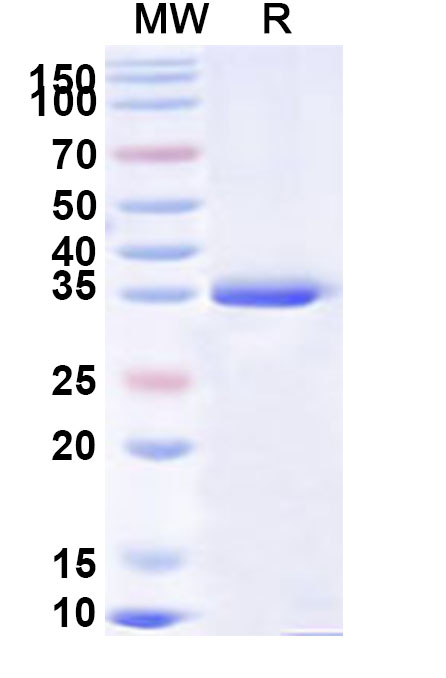 SDS-PAGE for Recombinant Human EYA2 Protein, N-His