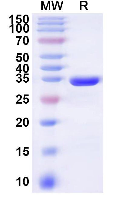 SDS-PAGE for Recombinant Human FAIM2 Protein, N-His-KSI