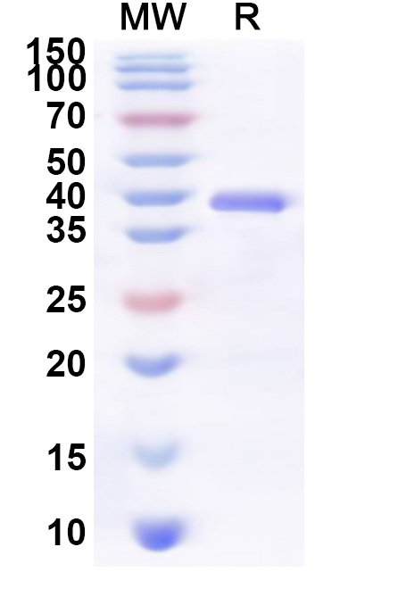 SDS-PAGE for Recombinant Human FCRL4 Protein, N-His