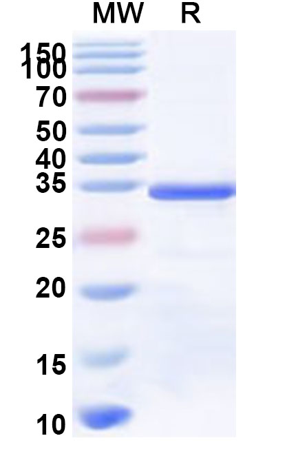SDS-PAGE for Recombinant Human FCRL5 Protein, N-His