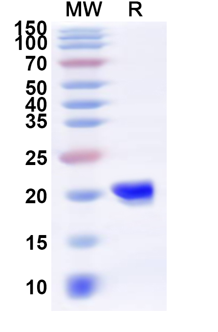 SDS-PAGE for Recombinant Human FHIT Protein, N-His