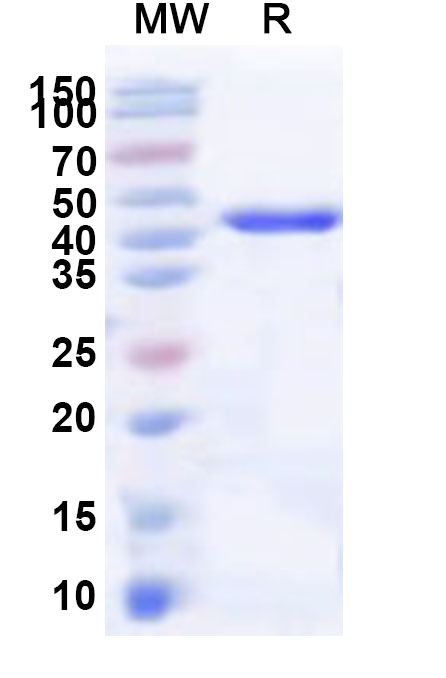 SDS-PAGE for Recombinant Human FMN1 Protein, N-His