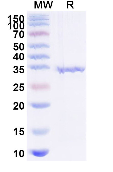 SDS-PAGE for Recombinant Human FN1 Protein, N-His