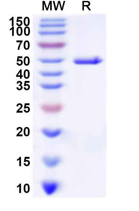 SDS-PAGE for Recombinant Human FNTB Protein, N-His