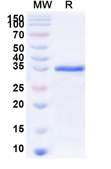 SDS-PAGE for Recombinant Human FOXE3 Protein, N-GST & C-His