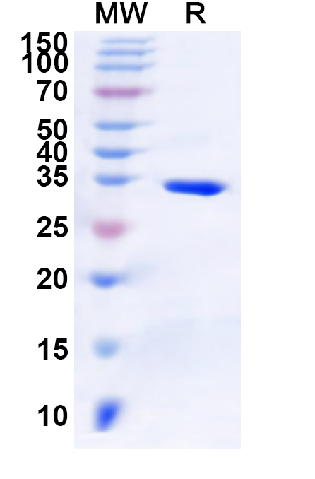 SDS-PAGE for Recombinant Human FOXF1 Protein, N-GST & C-His