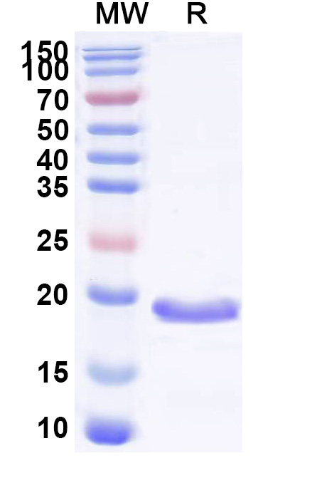 SDS-PAGE for Recombinant Human GABARAP Protein, N-His