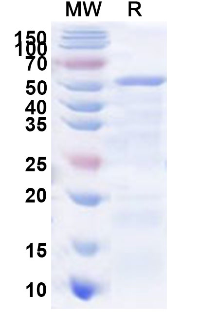 SDS-PAGE for Recombinant Human GALNT18 Protein, N-His