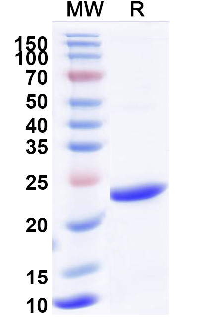 SDS-PAGE for Recombinant Human GAMT, N-His