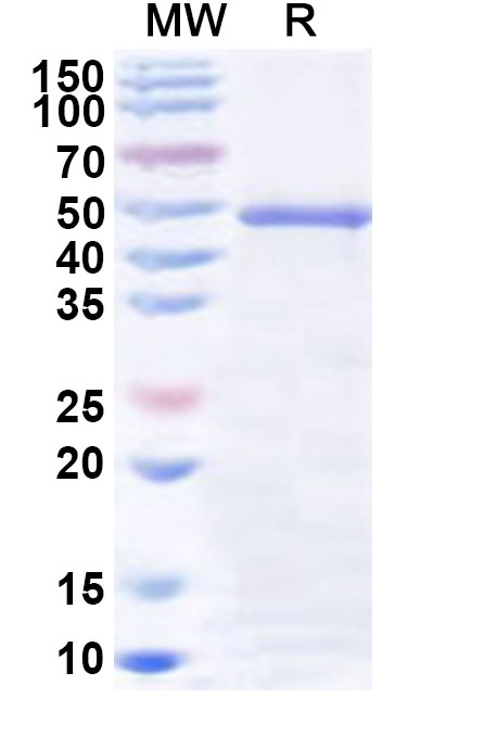 SDS-PAGE for Recombinant Human GCAT Protein, N-His