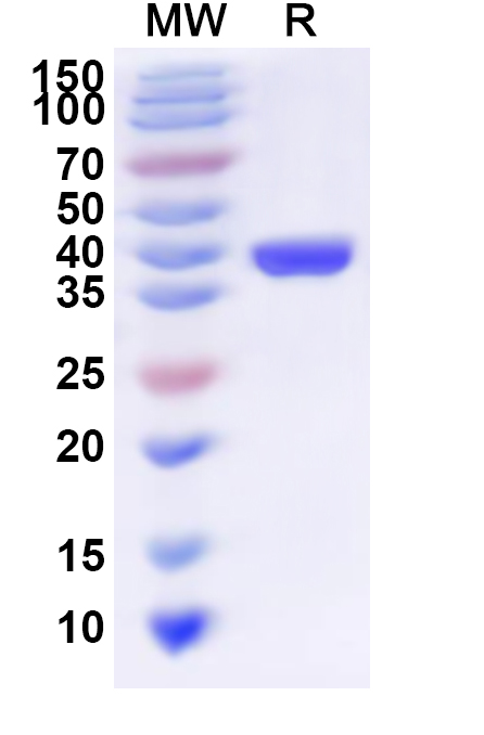 SDS-PAGE for Recombinant Human GCC1 Protein, N-His