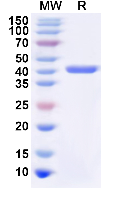 SDS-PAGE for Recombinant Human GCHFR Protein, N-GST & C-His