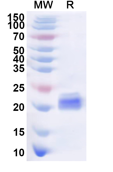 SDS-PAGE for Recombinant Human GFI1B Protein, N-His