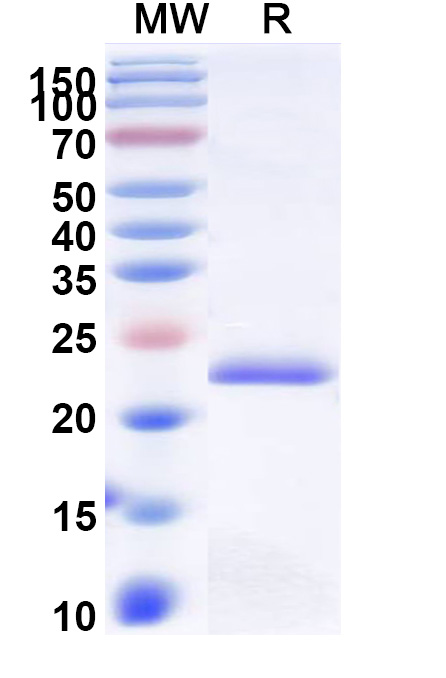 SDS-PAGE for Recombinant Human GGCT Protein, N-His