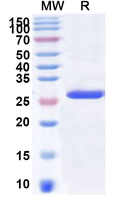 SDS-PAGE for Recombinant Human GHITM Protein, N-His-KSI