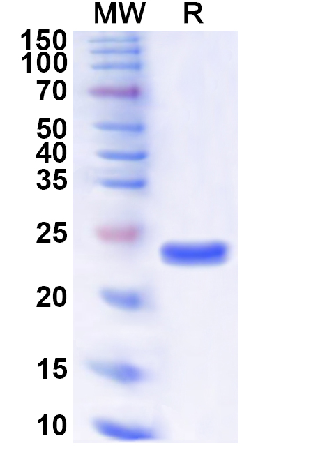 SDS-PAGE for Recombinant Human GINS1 Protein, N-His