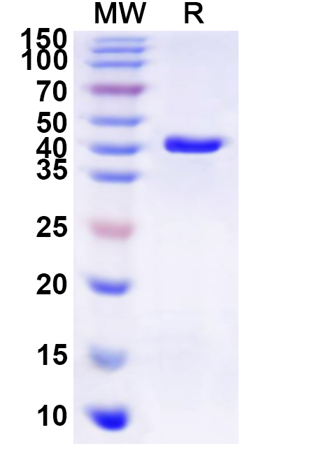 SDS-PAGE for Recombinant Human GJB5 Protein, N-GST & C-His