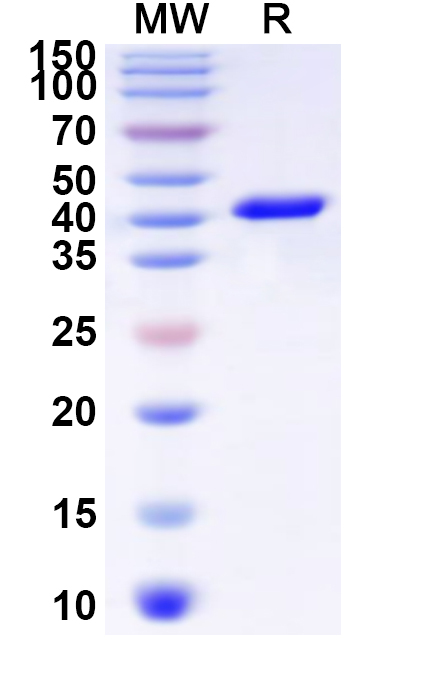 SDS-PAGE for Recombinant Human GJB6 Protein, N-GST & C-His