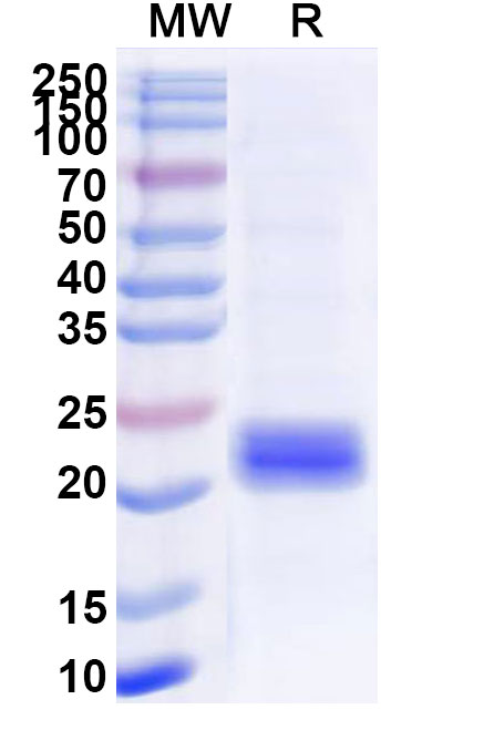 SDS-PAGE for Recombinant Human GLUT4/SLC2A4, N-SUMO
