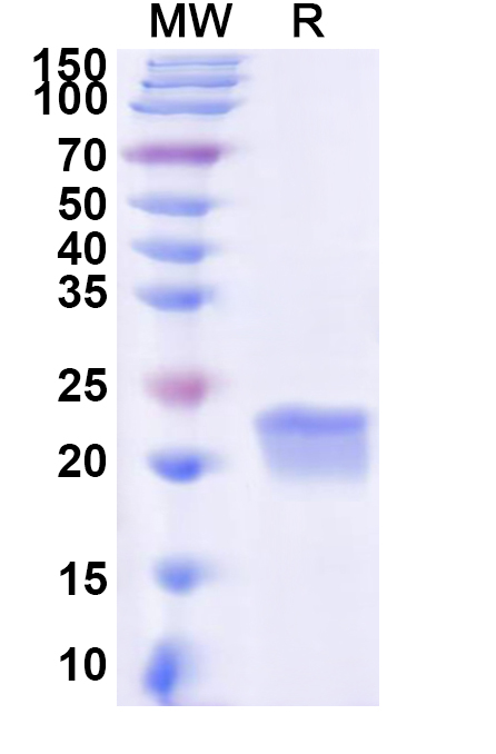 SDS-PAGE for Recombinant Human GM2A Protein, N-His