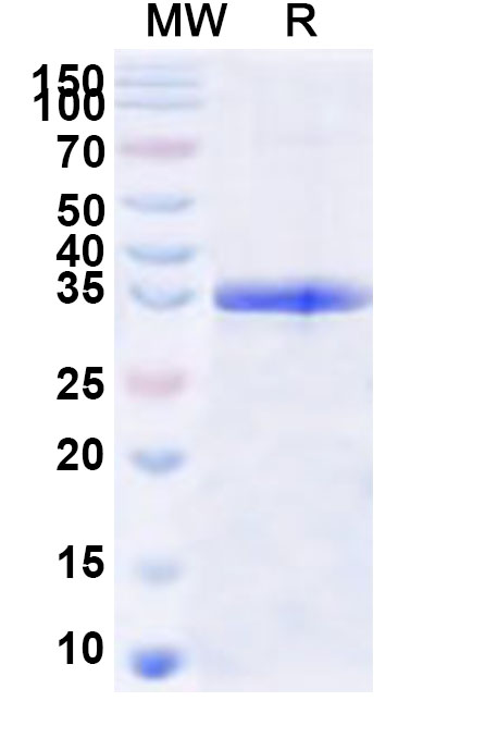 SDS-PAGE for Recombinant Human GNA13 Protein, N-His