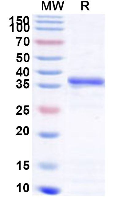 SDS-PAGE for Recombinant Human GNAI2 Protein, N-His