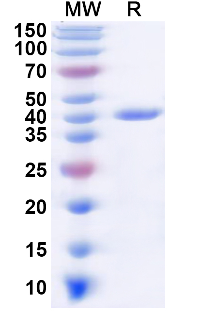 SDS-PAGE for Recombinant Human GNAL Protein, N-His