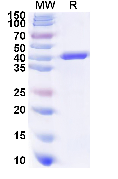 SDS-PAGE for Recombinant Human GNAT2 Protein, N-His